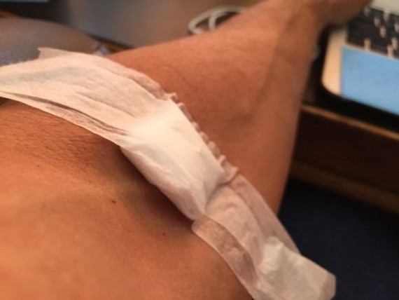 Bandage over blood draw needle insertion.